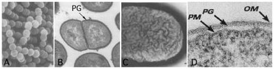 Electron micrographs and diagrams comparing Gram-positive and Gram-negative cell walls