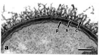 Transmission electron micrograph showing capsule, S-layer, and peptidoglycan