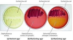 MacConkey agar as selective and differential medium