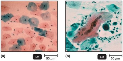 Cytopathic effect of viruses in cell culture
