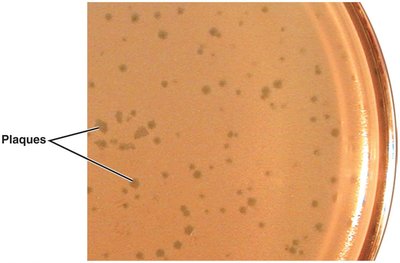 Viral plaques formed by bacteriophages