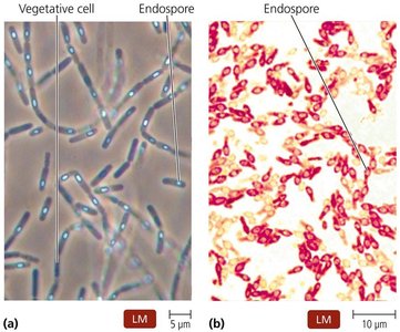 Locations of endospores