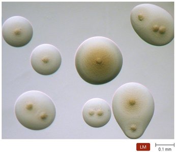 Fried egg appearance of Mycoplasma colonies