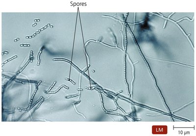 Branching filaments of actinomycetes