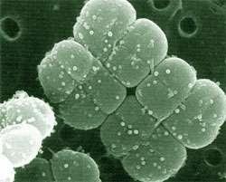 Deinococcus bacteria