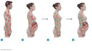 Hemolytic disease of the newborn