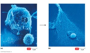 CTL attacking a cancer cell