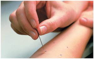 Skin test to identify allergens