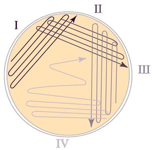Comparison of streak plates