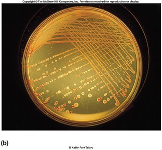 Colony morphology examples