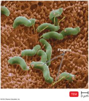 Helicobacter pylori on stomach cells