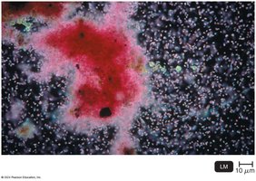 Purple sulfur bacteria