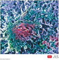 Mycoplasma pneumoniae morphology