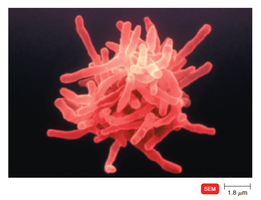 Actinomyces with conidiospores