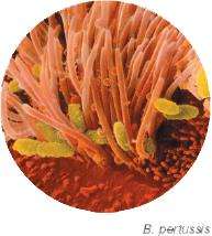 Micrograph of Bordetella pertussis on ciliated cells