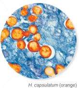Diagram of histoplasmosis infection and endemic areas