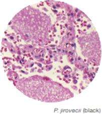 Micrograph of Rhizopus species
