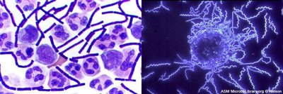 Microscopic images of bacteria