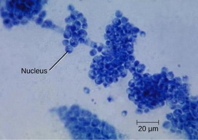Fungal spoilage of fruit