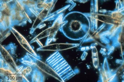 Tapeworms (helminths)