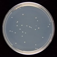Bacterial colonies on a culture plate