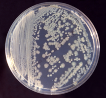 Trypticase Soy Agar plate with bacterial colonies