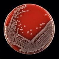 Blood Agar plate with bacterial colonies