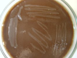 Chocolate Agar plate with bacterial growth