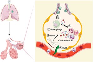 Diagram of infection and immune response in the lungs