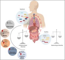 Diagram showing gut microbiota balance and its effects on health
