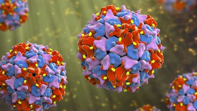 Child with polio-induced paralysis