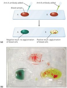 Hemagglutination for blood typing