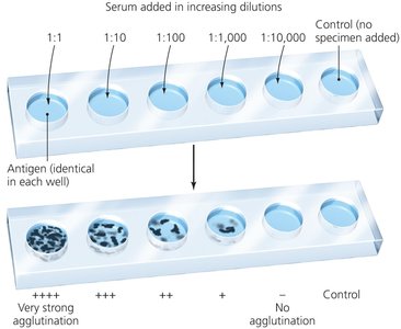 Agglutination titration to quantify antibodies