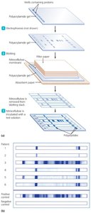 Immunoblotting (Western blotting) process
