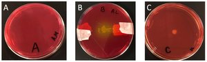 Mannitol Salt Agar plates showing color change