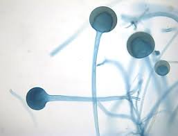 Rhizopus sporangia