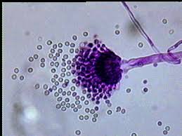 Microscopic view of Aspergillus