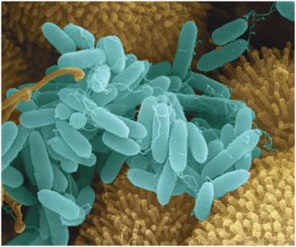 Pseudomonas aeruginosa bacteria