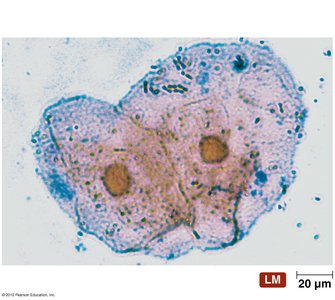 Comparison of prokaryotic and eukaryotic cells