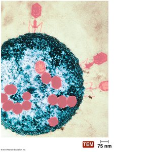 Viruses infecting a bacterium (TEM image)