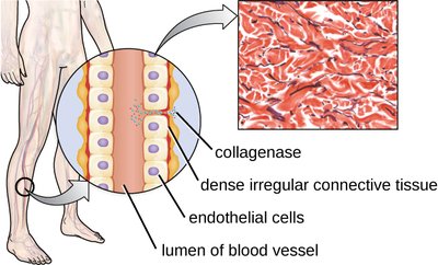 Diagram showing collagenase action on connective tissue