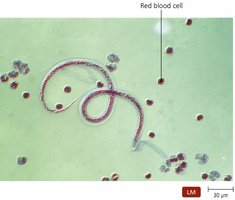 Microscopic image of a parasitic worm and red blood cells