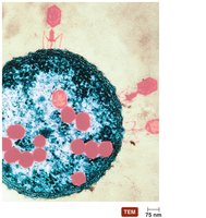 Electron micrograph of viruses assembling inside a cell