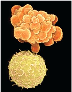Types of adaptive immunity: active and passive, natural and artificial