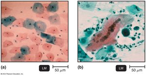 Cytopathic effect of viruses on cell cultures