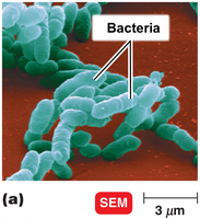 SEM image of bacteria