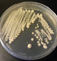 Colony of yeast growing on agar plate
