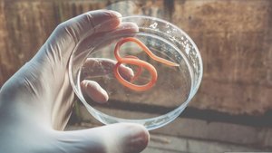 Helminth (worm) in a petri dish