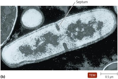 Septum formation in binary fission