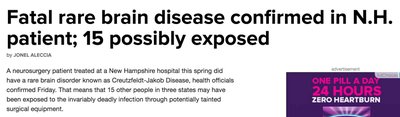News headline about prion disease transmission